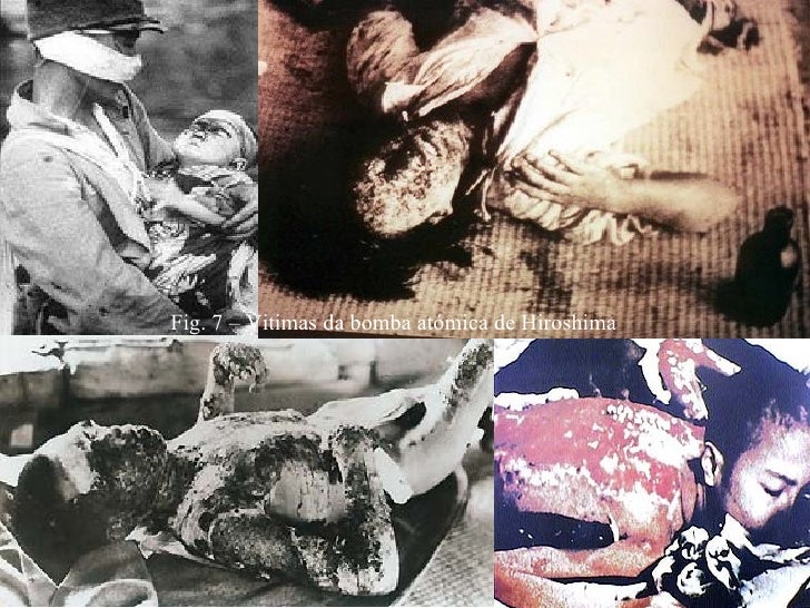 Fotos das vitimas da bomba atomica 68 Fotos das vitimas da bomba atomica 11
